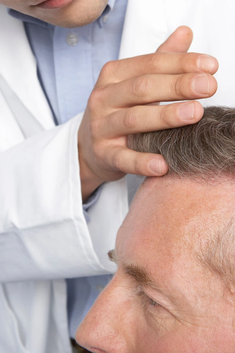 Man Consulting Hair Loss Surgeon For Hair Lowering Treatment