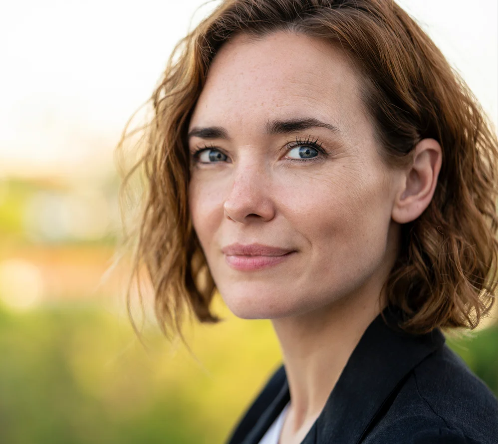 Buccal fat removal results showing refined cheek contour and slimmer lower face profile