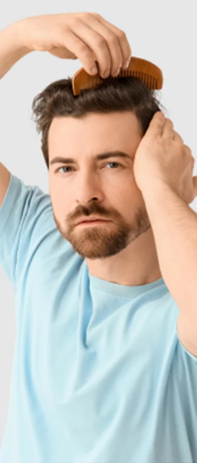 Man checking scalp during hair transplant recovery process